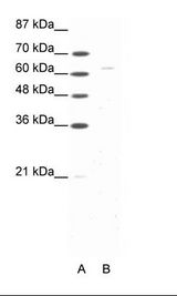 A: Marker, B: Raji Cell Lysate