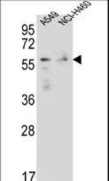 FOXN1 Antibody western blot of A549,NCI-H460 cell line lysates (35 ug/lane). The FOXN1 antibody detected the FOXN1 protein (arrow).