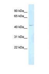 FOXN2 antibody LS-C145850 Western blot of COL0205 Cell lysate. Antibody concentration 1 ug/ml.