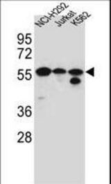 FOXN2 Antibody western blot of NCI-H292,Jurkat,K562 cell line lysates (35 ug/lane). The FOXN2 antibody detected the FOXN2 protein (arrow).