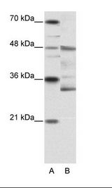 A: Marker, B: HepG2 Cell Lysate