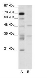 A: Marker, B: Jurkat Cell Lysate