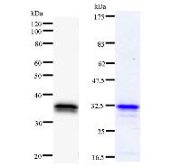 Left : Western blot analysis of immunized recombinant protein, using anti-CHES1 monoclonal antibody. Right : CBB staining of immunized recombinant protein.