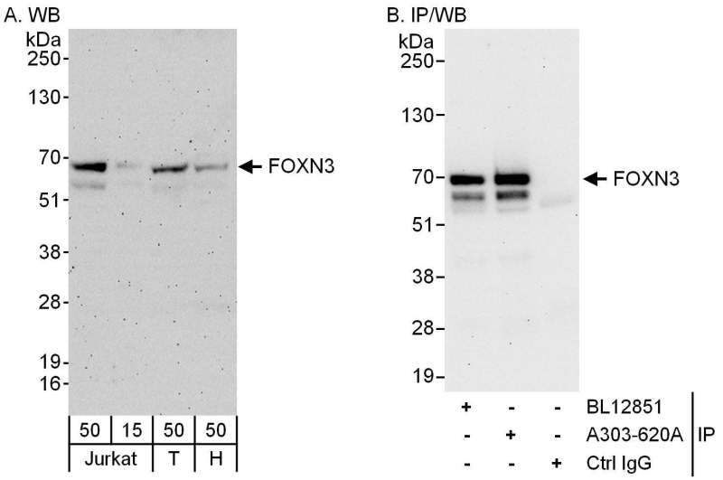 Detection of Human FOXN3 by Western Blot and Immunoprecipitation. Samples: Whole cell lysate from Jurkat (15 and 50 ug for WB; 1 mg for IP, 20% of IP loaded), 293T (T; 50 ug) and HeLa (H; 50 ug) cells. Antibodies: Affinity purified rabbit anti-FOXN3 antibody used for WB at 0.1 ug/ml (A) and 1 ug/ml (B) and used for IP at 6 ug/mg lysate. FOXN3 was also immunoprecipitated by rabbit anti-FOXN3 antibody BL12851, which recognizes a downstream epitope. Detection: Chemiluminescence with exposure times of 3 minutes (A) and 30 seconds (B).