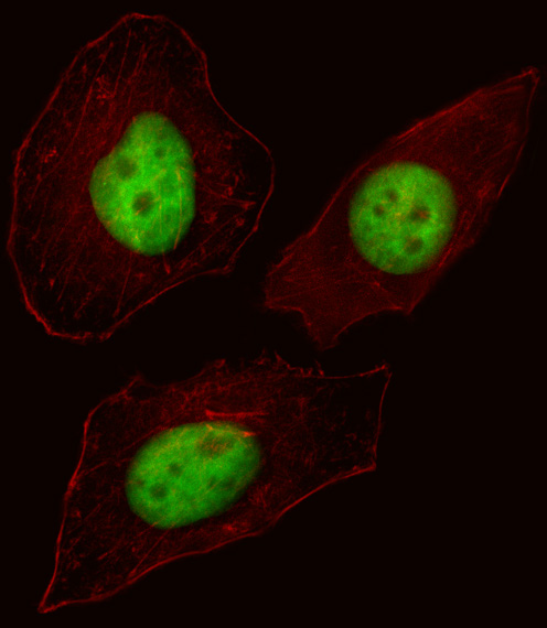 Fluorescent image of HeLa cell stained with FOXN3 Antibody. HeLa cells were fixed with 4% PFA (20 min), permeabilized with Triton X-100 (0.1%, 10 min), then incubated with FOXN3 primary antibody (1:25, 1 h at 37°C). For secondary antibody, Alexa Fluor 488 conjugated donkey anti-rabbit antibody (green) was used (1:400, 50 min at 37°C). Cytoplasmic actin was counterstained with Alexa Fluor 555 (red) conjugated Phalloidin (7units/ml, 1 h at 37°C). FOXN3 immunoreactivity is localized to Nucleus significantly.