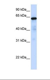 Hela cell lysate. Antibody concentration: 1.0 ug/ml. Gel concentration: 12%.