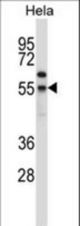 FOXN4 Antibody western blot of HeLa cell line lysates (35 ug/lane). The FOXN4 antibody detected the FOXN4 protein (arrow).