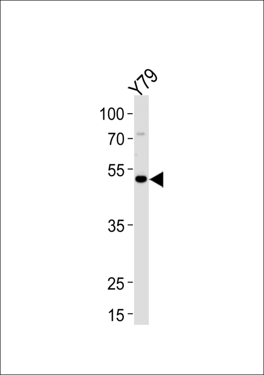 Western blot of lysate from Y79 cell line, using FOXN4 Antibody. Antibody was diluted at 1:1000 at each lane. A goat anti-rabbit IgG H&L (HRP) at 1:5000 dilution was used as the secondary antibody. Lysate at 35ug.