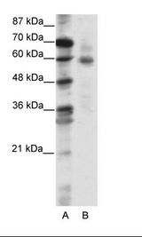 A: Marker, B: Jurkat Cell Lysate