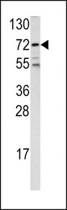 Western blot of FKHR antibody (Center D469) in 293 cell line lysates (35 ug/lane). FKHR (arrow) was detected using the purified antibody.