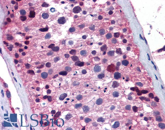 Anti-FOXO1 antibody IHC of human testis. Immunohistochemistry of formalin-fixed, paraffin-embedded tissue after heat-induced antigen retrieval. Antibody LS-B5595 concentration 5 ug/ml.