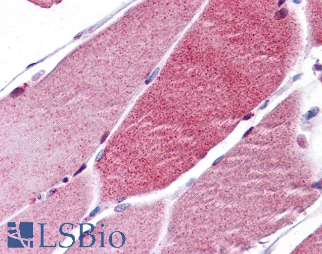 Anti-FOXO3A antibody IHC of human skeletal muscle. Immunohistochemistry of formalin-fixed, paraffin-embedded tissue after heat-induced antigen retrieval. Antibody LS-B5284 concentration 5 ug/ml.