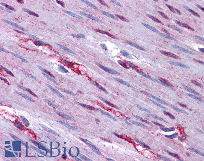 Anti-FOXO3A antibody IHC of human colon, muscularis propria and nerve. Immunohistochemistry of formalin-fixed, paraffin-embedded tissue after heat-induced antigen retrieval. Antibody LS-B5284 concentration 5 ug/ml.