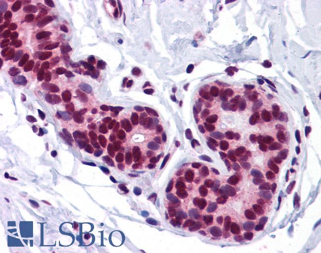 Anti-FOXO3A antibody IHC of human breast. Immunohistochemistry of formalin-fixed, paraffin-embedded tissue after heat-induced antigen retrieval. Antibody LS-B5284 concentration 5 ug/ml.