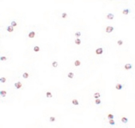Immunocytochemistry of FOXO3 in A-20 cells with FOXO3 antibody at 4 ug/ml.
