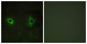 Immunofluorescence of COS7 cells, using Collagen IV alpha3 Antibody. The picture on the right is treated with the synthesized peptide.