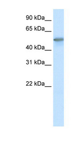 FOXO3 / FOXO3A antibody LS-B952 Western blot of Fetal skeletal muscle lysate.