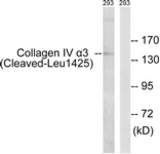 Western blot of extracts from 293 cells, treated with etoposide 25 uM 1h, using Collagen IV alpha3 (Cleaved-Leu1425) Antibody. The lane on the right is treated with the synthesized peptide.