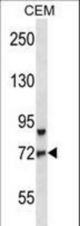 FOXO3 Antibody western blot of CEM cell line lysates (35 ug/lane). The FOXO3 antibody detected the FOXO3 protein (arrow).