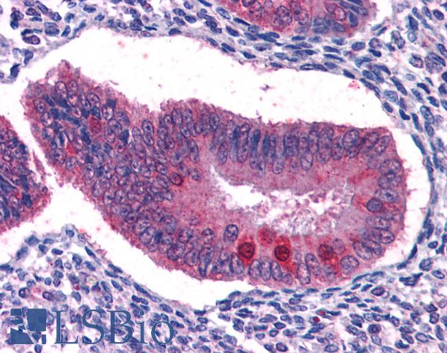 Anti-FOXO3A antibody IHC of human uterus. Immunohistochemistry of formalin-fixed, paraffin-embedded tissue after heat-induced antigen retrieval. Antibody LS-B3932 concentration 2.5 ug/ml.