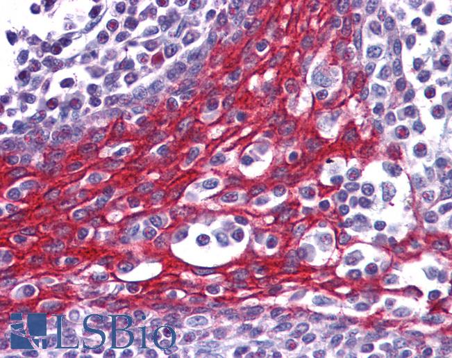Anti-FOXO3A antibody IHC of human tonsil. Immunohistochemistry of formalin-fixed, paraffin-embedded tissue after heat-induced antigen retrieval. Antibody LS-B3932 concentration 2.5 ug/ml.