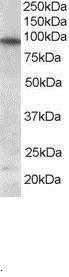 Staining (0.5 ug/ml) of Human Brain lysate (RIPA buffer, 35 ug total protein per lane). Primary incubated for 1 hour. Detected using chemiluminescence.