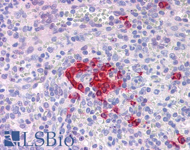 Anti-FOXO4 antibody IHC of human spleen. Immunohistochemistry of formalin-fixed, paraffin-embedded tissue after heat-induced antigen retrieval. Antibody LS-B5285 concentration 5 ug/ml.