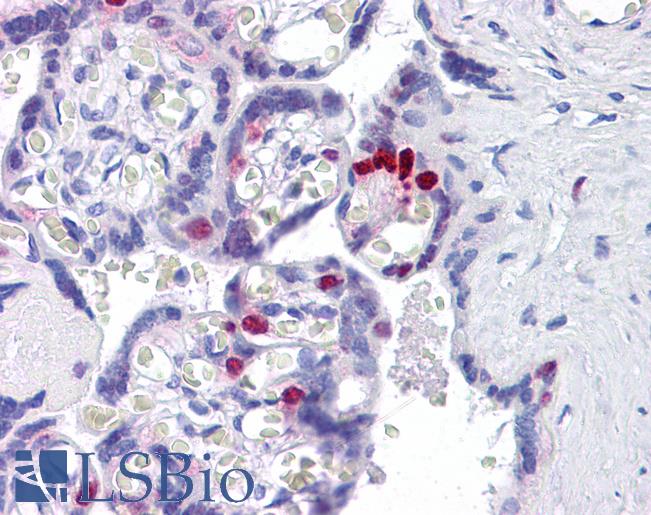 Anti-FOXO4 antibody IHC of human placenta. Immunohistochemistry of formalin-fixed, paraffin-embedded tissue after heat-induced antigen retrieval. Antibody LS-B5285 concentration 5 ug/ml.