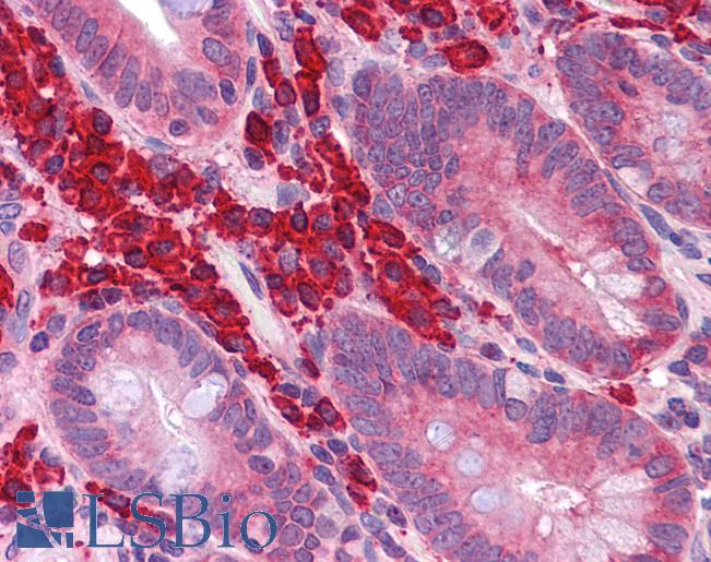 Anti-FOXO4 antibody IHC of human small intestine. Immunohistochemistry of formalin-fixed, paraffin-embedded tissue after heat-induced antigen retrieval. Antibody LS-B5285 concentration 5 ug/ml.