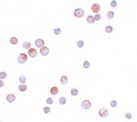 Immunocytochemistry of FOXO4 in HeLa cells with FOXO4 antibody at 10 ug/ml.