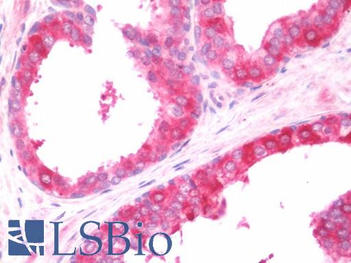 Anti-COL4A3BP / CERT antibody IHC staining of human prostate. Immunohistochemistry of formalin-fixed, paraffin-embedded tissue after heat-induced antigen retrieval. Antibody LS-B10904 concentration 7.5 ug/ml.