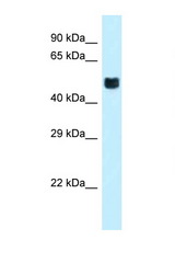 FOXO4 antibody LS-C145800 Western blot of Mouse Pancreas lysate. Antibody concentration 1 ug/ml.