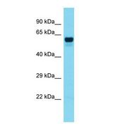 Western blot of Human Colorectal Tumor. FOXO6 antibody dilution 1.0 ug/ml.