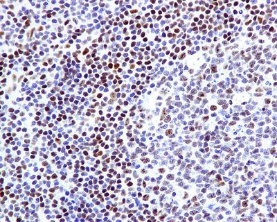 IHC of paraffin-embedded human tonsil tissue using anti-FOXP1 antibody.