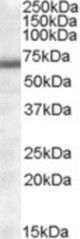 Antibody (1 ug/ml) staining of Human Heart lysate (35 ug protein in RIPA buffer). Primary incubation was 1 hour. Detected by chemiluminescence