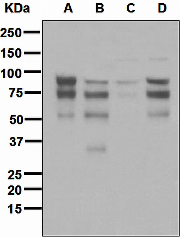 Western blot analysis on (A) Daudi, (B) MCF-7, (C) T47-D, and (D) Jurkat cell lysates using anti-FOXP1 antibody.