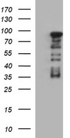HEK293T cells were transfected with the pCMV6-ENTRY control (Left lane) or pCMV6-ENTRY FOXP1 (Right lane) cDNA for 48 hrs and lysed. Equivalent amounts of cell lysates (5 ug per lane) were separated by SDS-PAGE and immunoblotted with anti-FOXP1.