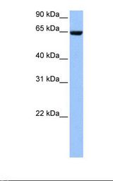 Hela cell lysate. Antibody concentration: 1.0 ug/ml. Gel concentration: 12%.