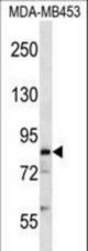 COL4A3BP Antibody western blot of MDA-MB453 cell line lysates (35 ug/lane). The COL4A3BP antibody detected the COL4A3BP protein (arrow).