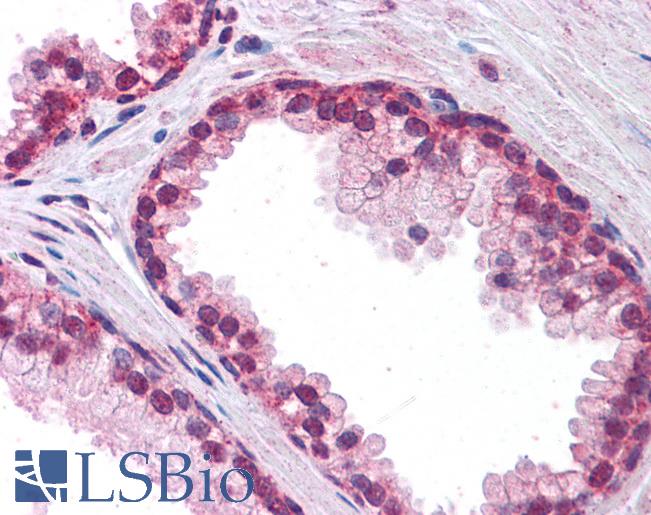 Anti-FOXP2 antibody IHC of human prostate. Immunohistochemistry of formalin-fixed, paraffin-embedded tissue after heat-induced antigen retrieval. Antibody LS-B4346 concentration 2.5 ug/ml.