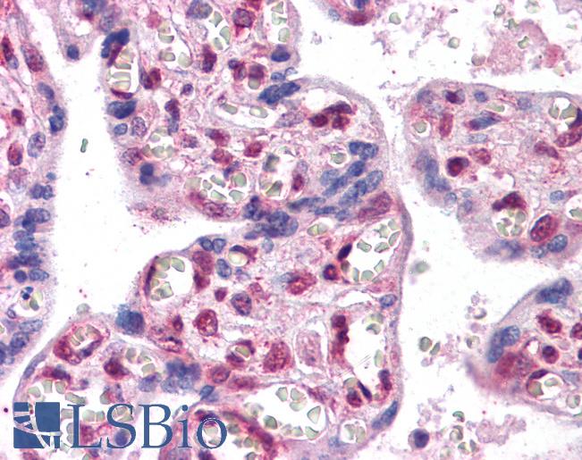 Anti-FOXP2 antibody IHC of human placenta. Immunohistochemistry of formalin-fixed, paraffin-embedded tissue after heat-induced antigen retrieval. Antibody LS-B4346 concentration 2.5 ug/ml.