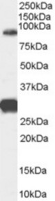 Antibody (0.3 ug/ml) staining of Human Brain (Cerebellum) lysate (35 ug protein in RIPA buffer). Primary incubation was 1 hour. Detected by chemiluminescence.