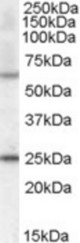 Antibody (0.5 ug/ml) staining of mouse heart lysate (35 ug protein in RIPA buffer). Primary incubation was 1 hour. Detected by chemiluminescence.