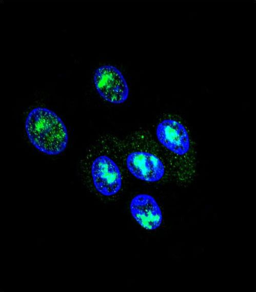Confocal immunofluorescent of FOXP2 Antibody with HepG2 cell followed by Alexa Fluor 488-conjugated goat anti-rabbit lgG (green). DAPI was used to stain the cell nuclear (blue).