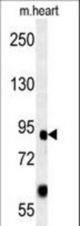 FOXP2 Antibody western blot of mouse heart tissue lysates (15 ug/lane). The FOXP2 antibody detected FOXP2 protein (arrow).