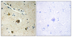 IHC of paraffin-embedded human brain tissue, using Collagen IV alpha4 Antibody. The picture on the right is treated with the synthesized peptide.