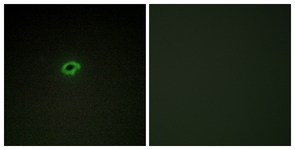 Immunofluorescence of COS7 cells, using Collagen IV alpha4 Antibody. The picture on the right is treated with the synthesized peptide.