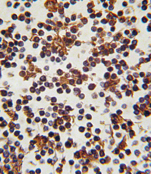 Formalin-fixed and paraffin-embedded human lymph tissue reacted with FOXP3 antibody , which was peroxidase-conjugated to the secondary antibody, followed by DAB staining. This data demonstrates the use of this antibody for immunohistochemistry; clinical relevance has not been evaluated.