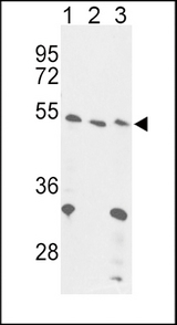 Western blot of FOXP3 Antibody in 293(lane 1), Jurkat cell line(lane 2) and mouse liver tissue(lane 3) lysates (35 ug/lane). FOXP3 (arrow) was detected using the purified antibody.