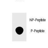 Dot blot of anti-Phospho-FOXP3-S418 Phospho-specific antibody on nitrocellulose membrane. 50ng of Phospho-peptide or Non Phospho-peptide per dot were adsorbed. Antibody working concentrations are 0.5ug per ml.